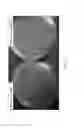 Fig. 06 - Biological devices and methods of use thereof for the study and control of alzheimer's disease