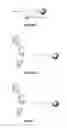 Fig. 02 - Affinity chromatography matrix