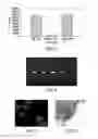 Fig. 03 - Method for treating tumors that possess the CCK-C receptor with the 3B9.1 monoclonal antibody