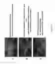 Fig. 34 - Method of treating cancer with an EGFR targeted immunomodulatory fusion protein
