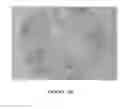 Fig. 11 - Antibodies to MUC16 and methods of use thereof