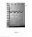 Fig. 02 - Method of treating myocardial infarction by administering a bi-specific fusion protein