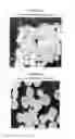 Fig. 06 - Spheroidal catalyst for olefin polymerization