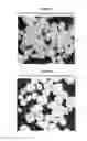 Fig. 07 - Spheroidal catalyst for olefin polymerization