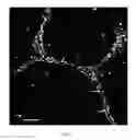 Fig. 03 - Engineered lumenized vascular networks and support matrix
