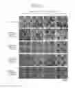 Fig. 04 - Cell Culturing Method, Particulate Culture Carrier, and Particle-Encompassing Cell Aggregate