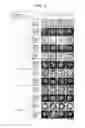 Fig. 10 - Cell Culturing Method, Particulate Culture Carrier, and Particle-Encompassing Cell Aggregate