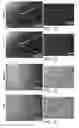 Fig. 03 - Isolation, expansion and use of clonogenic endothelial progenitor cells
