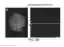 Fig. 14 - Isolation, expansion and use of clonogenic endothelial progenitor cells