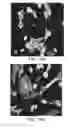 Fig. 26 - Isolation, expansion and use of clonogenic endothelial progenitor cells