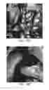 Fig. 27 - Isolation, expansion and use of clonogenic endothelial progenitor cells