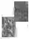 Fig. 03 - DIFFERENTIATED CELLULAR COMPOSITIONS AND METHODS FOR THEIR PREPARATION AND USE