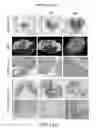 Fig. 19 - TISSUE ENGINEERED MODELS OF CANCERS