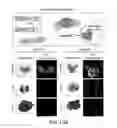 Fig. 20 - TISSUE ENGINEERED MODELS OF CANCERS