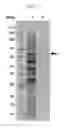 Fig. 03 - Thermostable beta-glucosidase