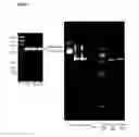 Fig. 11 - Bacterial hyaluronidase and process for its production