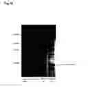 Fig. 19 - Bacterial hyaluronidase and process for its production
