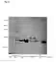 Fig. 21 - Bacterial hyaluronidase and process for its production