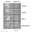 Fig. 37 - Methods and compositions using miR-3151 in the diagnosis and treatment of thyroid cancer