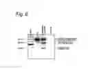 Fig. 08 - MODULATION OF EXON RECOGNITION IN PRE-MRNA BY INTERFERING WITH THE SECONDARY RNA STRUCTURE