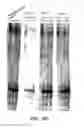 Fig. 20 - ANTISENSE DESIGN