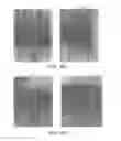 Fig. 11 - METABOLICALLY ACTIVATED RECOMBINANT VIRAL VECTORS AND METHODS FOR THEIR PREPARATION AND USE