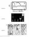 Fig. 11 - Construction of fully-deleted adenovirus-based gene delivery vectors and uses thereof