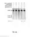 Fig. 06 - ONCOGENIC MODELS BASED ON DELIVERY AND USE OF THE CRISPR-CAS SYSTEMS, VECTORS AND COMPOSITIONS