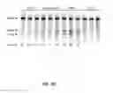 Fig. 09 - ONCOGENIC MODELS BASED ON DELIVERY AND USE OF THE CRISPR-CAS SYSTEMS, VECTORS AND COMPOSITIONS