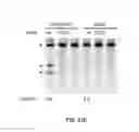 Fig. 45 - ONCOGENIC MODELS BASED ON DELIVERY AND USE OF THE CRISPR-CAS SYSTEMS, VECTORS AND COMPOSITIONS