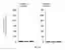 Fig. 05 - IMMEDIATE CHROMATIN IMMUNOPRECIPITATION AND ANALYSIS