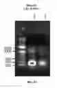 Fig. 16 - IMMEDIATE CHROMATIN IMMUNOPRECIPITATION AND ANALYSIS