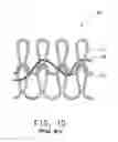 Fig. 05 - Knit reinforcing fabric