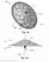 Fig. 06 - Braided medical device and manufacturing method thereof