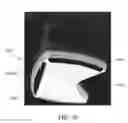 Fig. 10 - Collapsible canopy
