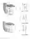 Fig. 10 - Screwless Mounted Short-Throw Lock for Sliding Windows and Doors