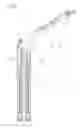 Fig. 11 - Adjusting device