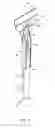 Fig. 05 - Remote controlled motorized wand for controlling blinds