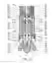 Fig. 04 - Apparatus for drilling deeper and wider well bore with casing