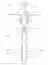 Fig. 09 - Assembly and method for multi-zone fracture stimulation of a reservoir using autonomous tubular units