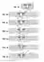 Fig. 04 - Wellbore treatment apparatus and method