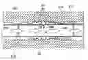 Fig. 01 - Active external casing packer (ECP) for frac operations in oil and gas wells