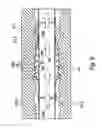 Fig. 09 - Active external casing packer (ECP) for frac operations in oil and gas wells