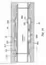Fig. 16 - Active external casing packer (ECP) for frac operations in oil and gas wells