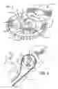 Fig. 05 - Cam phaser lockout kit and method