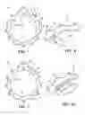 Fig. 07 - Piloting of a bearing housing-supported adjustment ring
