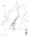 Fig. 04 - Gas turbine engine and thrust reverser assembly therefore