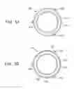 Fig. 04 - PULSATION DAMPER AND HIGH-PRESSURE FUEL PUMP