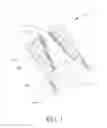 Fig. 02 - Plasma actuating propulsion system for aerial vehicles