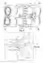 Fig. 04 - Gear pump bearing dam